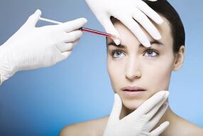 Plasmolifting procedure to rejuvenate the skin
